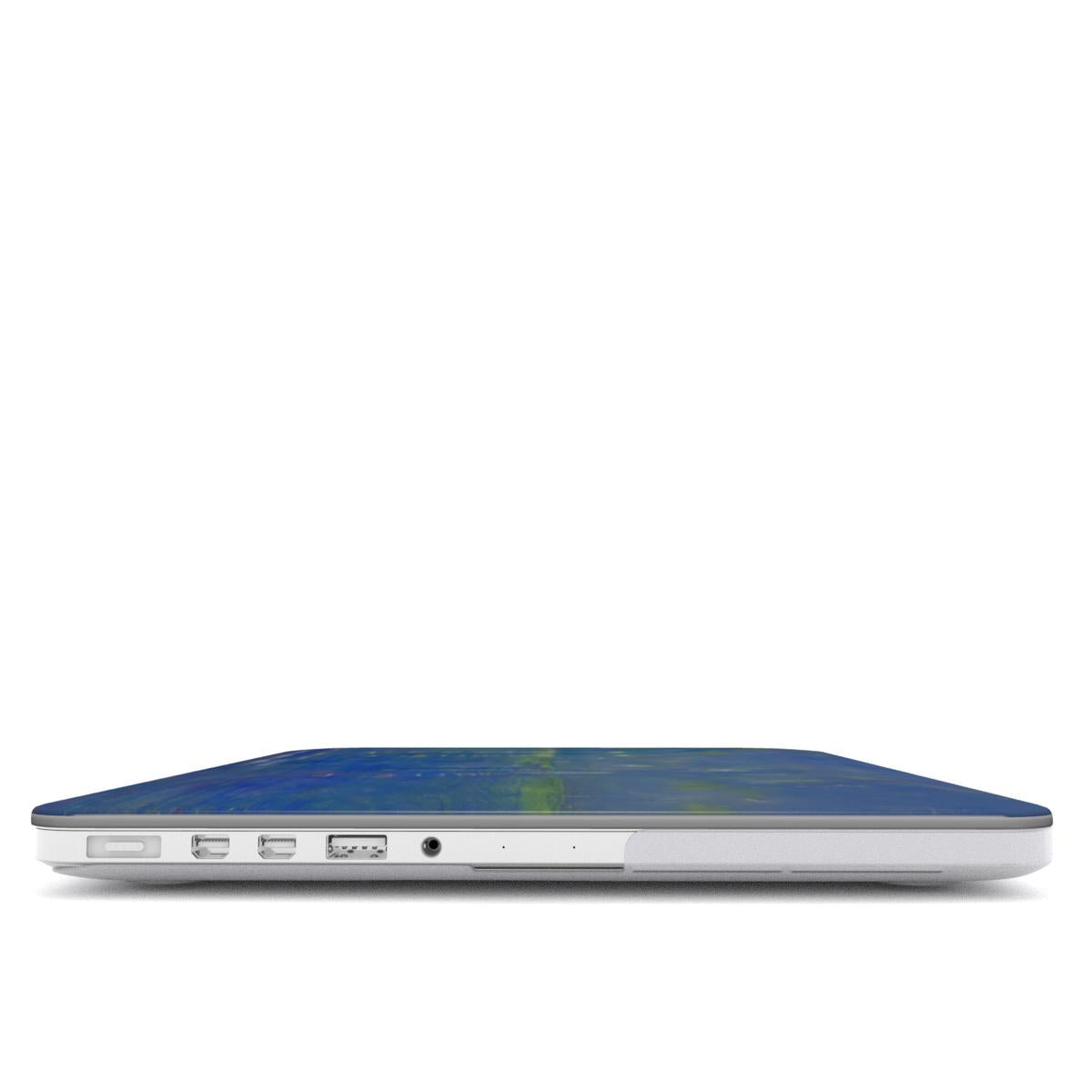 Creation of the World V - MacBook Case